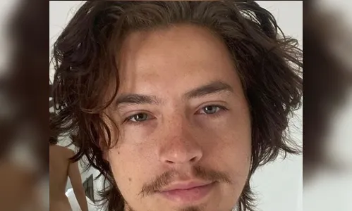 Astro de Riverdale posta 'nude' inusitada e choca fãs