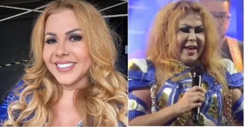 Joelma é diagnosticada com esofagite, gastrite e edema