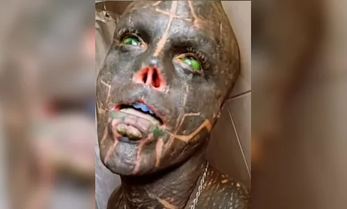 'Alien Negro' faz nova modificação corporal e agora tem duas bocas