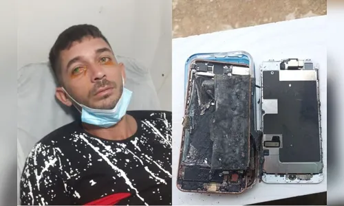 Agricultor fica ferido após celular explodir em seu rosto