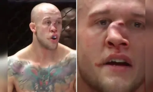 VÍDEO: lutador sofre fratura grave no nariz após levar joelhada