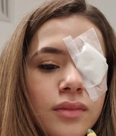 Na noite desta segunda-feira (29), ela compartilhou nas redes sociais uma imagem em que aparece com gaze nos olhos