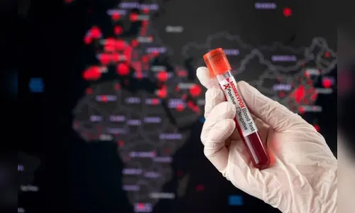 Monkeypox: ator compartilha fotos de evolução das feridas; Veja