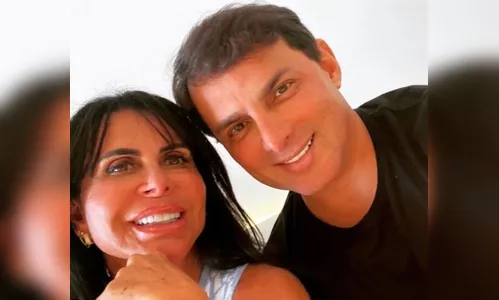 Marido de Gretchen mostra antes e depois da harmonização; veja
