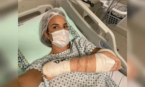 Ivete Sangalo faz cirurgia no braço após cair esquiando