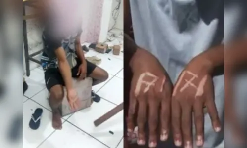 Jovem é espancado e marcado a ferro por patrão na Bahia; saiba mais