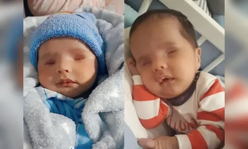 Família pede ajuda para custear cirurgia que fará bebê enxergar