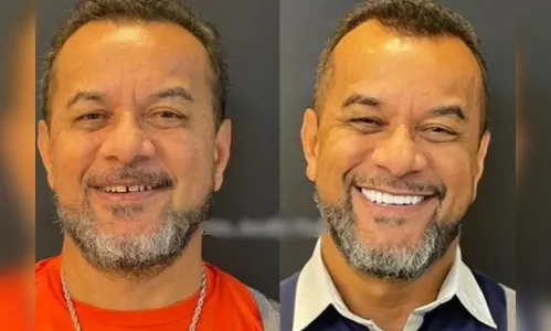 Homem morre de infecção após colocar facetas dentárias, diz marido