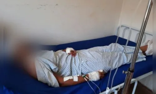 Após sonhar com traição, homem tenta matar a esposa com facadas