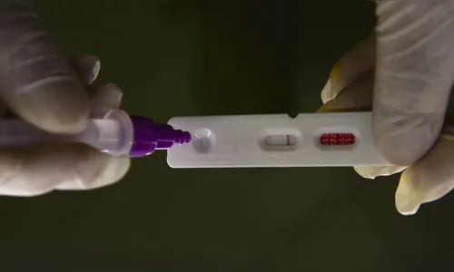 Brasil registra 11.722 casos de covid-19 e 92 mortes em 24 horas