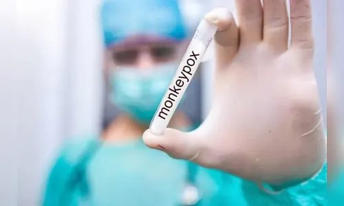 Saúde determina que planos cubram teste para varíola dos macacos