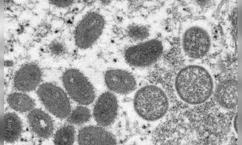 Paraná confirma mais 38 casos da varíola dos macacos