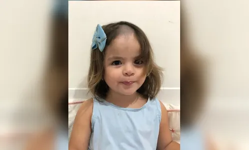 Menina de 2 anos raspa cabelo escondida dos pais e viraliza; assista