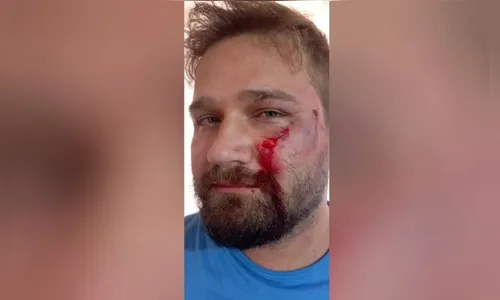 Médico é agredido com capacete após negar atestado de 3  dias; entenda