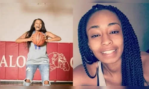 Mulher morre em aeroporto após cabelo enroscar em máquina de bagagem