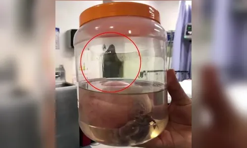 Médico registra ‘aparição da Morte’ minutos após cirurgia