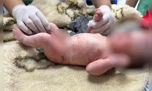 Mulher que alegou ter achado bebê em saco de lixo é a mãe da criança