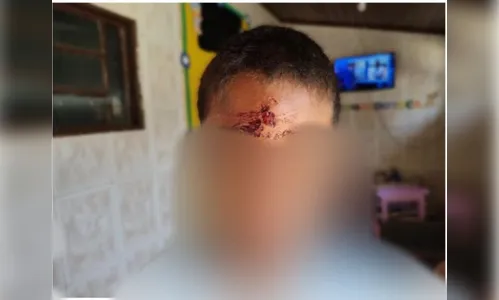 Mãe é presa por jogar pedra na testa do filho de 7 anos; confira