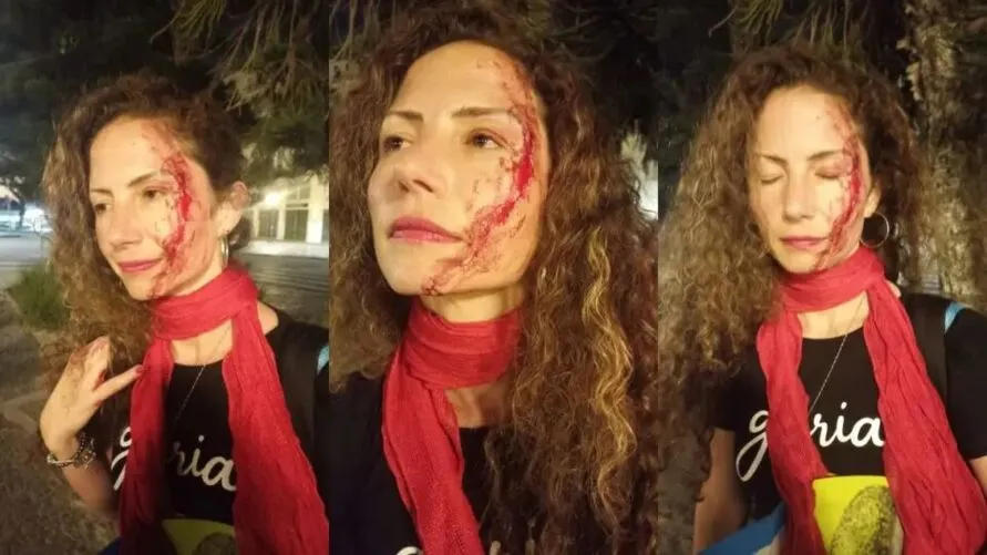 A jornalista Magalea Mazziotti, de 43 anos, foi agredida em Curitiba
