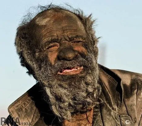 Amou Haji, conhecido como "o homem mais sujo do mundo"