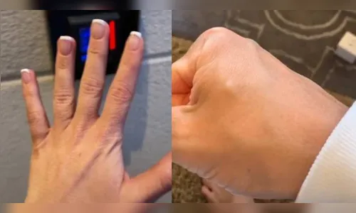 Casal implanta chip para controlar aparelhos eletrônicos; vídeo