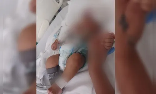 Bebê morre após pai arremessar celular nele ao tentar atingir a mulher