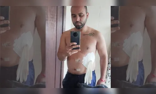 PR: médico coloca luva em paciente ao invés de bolsa de colostomia