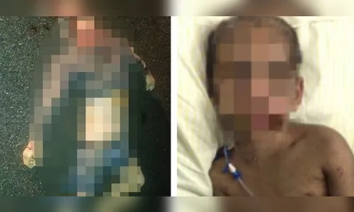 Padrasto que espancou e quebrou costelas de menino é morto em SP