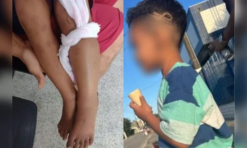 Criança é internada após confundir cobra com galho durante brincadeira