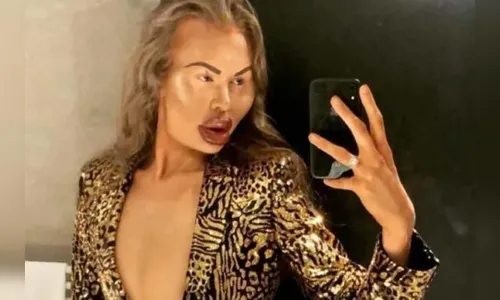 Homem aplica preenchimentos em si mesmo e fica com rosto deformado