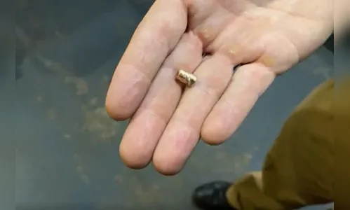 Homem sobrevive após levar tiro na nuca que saiu pela boca