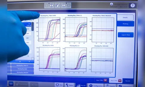 Sesa registra mais sete casos confirmados de Monkeypox no Paraná