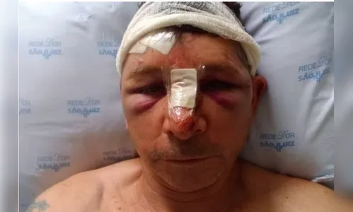 'Milagre': bloco de concreto se solta de viaduto e atinge aposentado