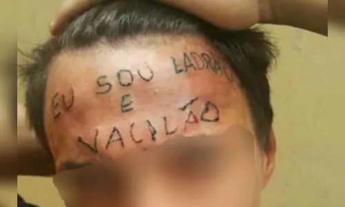 Jovem que teve a testa tatuada é preso por furto