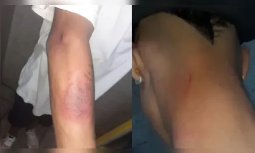 Policial rodoviário federal agride funcionário de conveniência