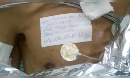 Idoso levado vivo para funerária tem morte confirmada pela polícia