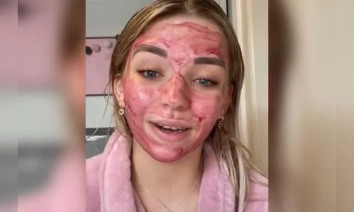 Trend TikTok: veja os riscos de usar sangue menstrual na pele