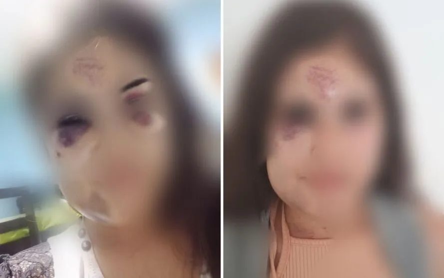 A mulher, de 26 anos, precisou ser internada depois da agressão, em Planaltina