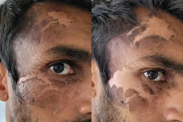 Astrit Mala, de 47anos, chegou a jogar água fervente em um deles, causando graves lesões