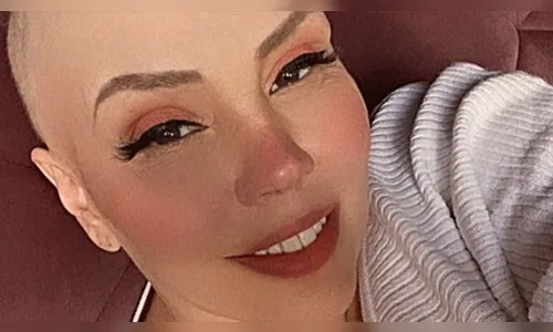 'Tratamento mais doloroso da minha vida', diz Simony