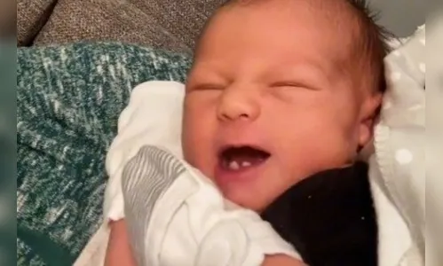 Bebê nasce com três dentes e vídeo viraliza na web