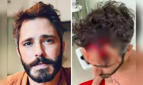 Polícia desmente Thiago Rodrigues e nega assalto: 