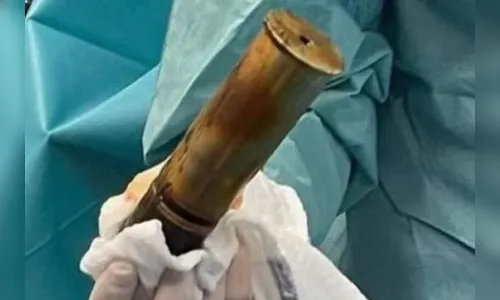 Idoso faz hospital ser evacuado ao chegar com bomba no ânus