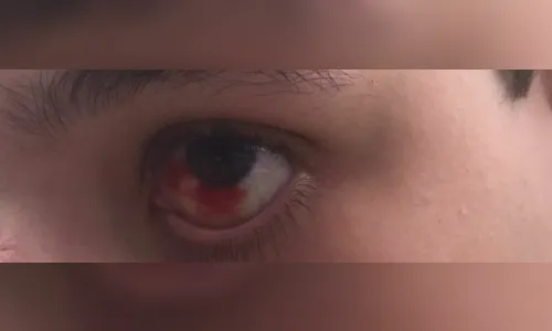 Jovem é agredido com soco ao negar entregar sorvete, em Apucarana