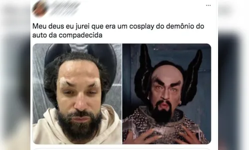 Virou meme: Latino faz procedimento estético e vira 