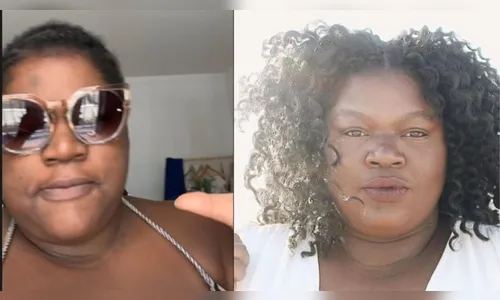 Influencer relata cegueira temporária causada por pomada capilar