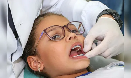 Programa de Aparelhos Ortodônticos atendeu 307 alunos em Apucarana