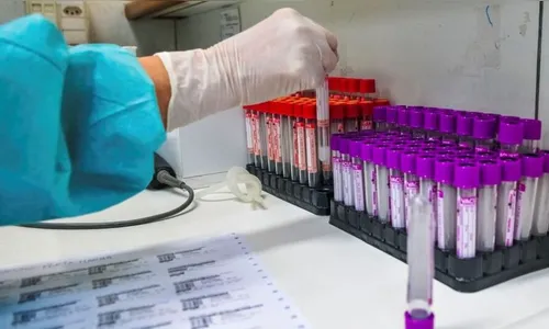 Saúde confirma mais 1.267 casos de Covid no Paraná