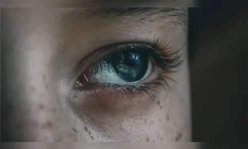 Olhos amarelos fazem mulher descobrir câncer terminal