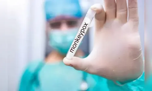 Sesa confirma cinco novos casos de Monkeypox no Paraná